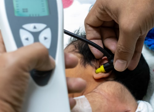 Baby getting hearing tested.